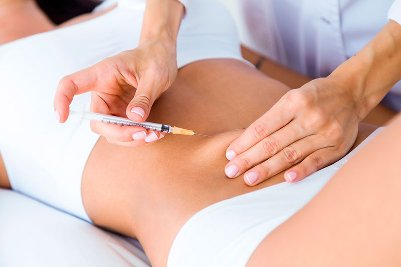 Intradermoterapia