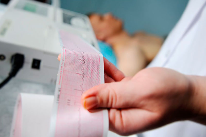 eletrocardiograma-1