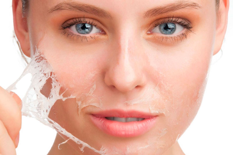 peeling